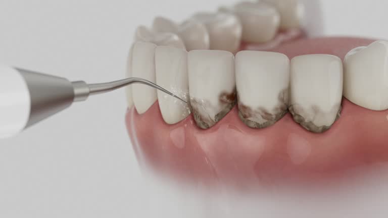 Reliable Dental Implants contractor in Willacoochee, GA by Smile Center Dentistry